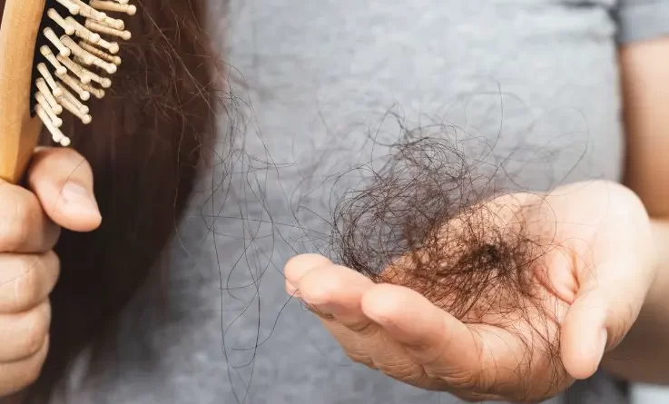 rimedi-naturali-caduta-capelli